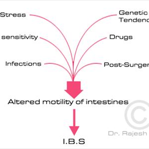 Ibs Medicine - Diets For Irritable Bowel Syndrome