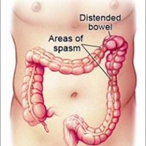 Ibs Nutrition Guide - Irritable Bowel Syndrome - Help For Ibs Treatment